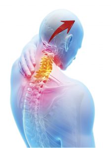 cervicogenic headache exercises
