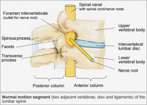cervical radiculopathy treatment anatomy