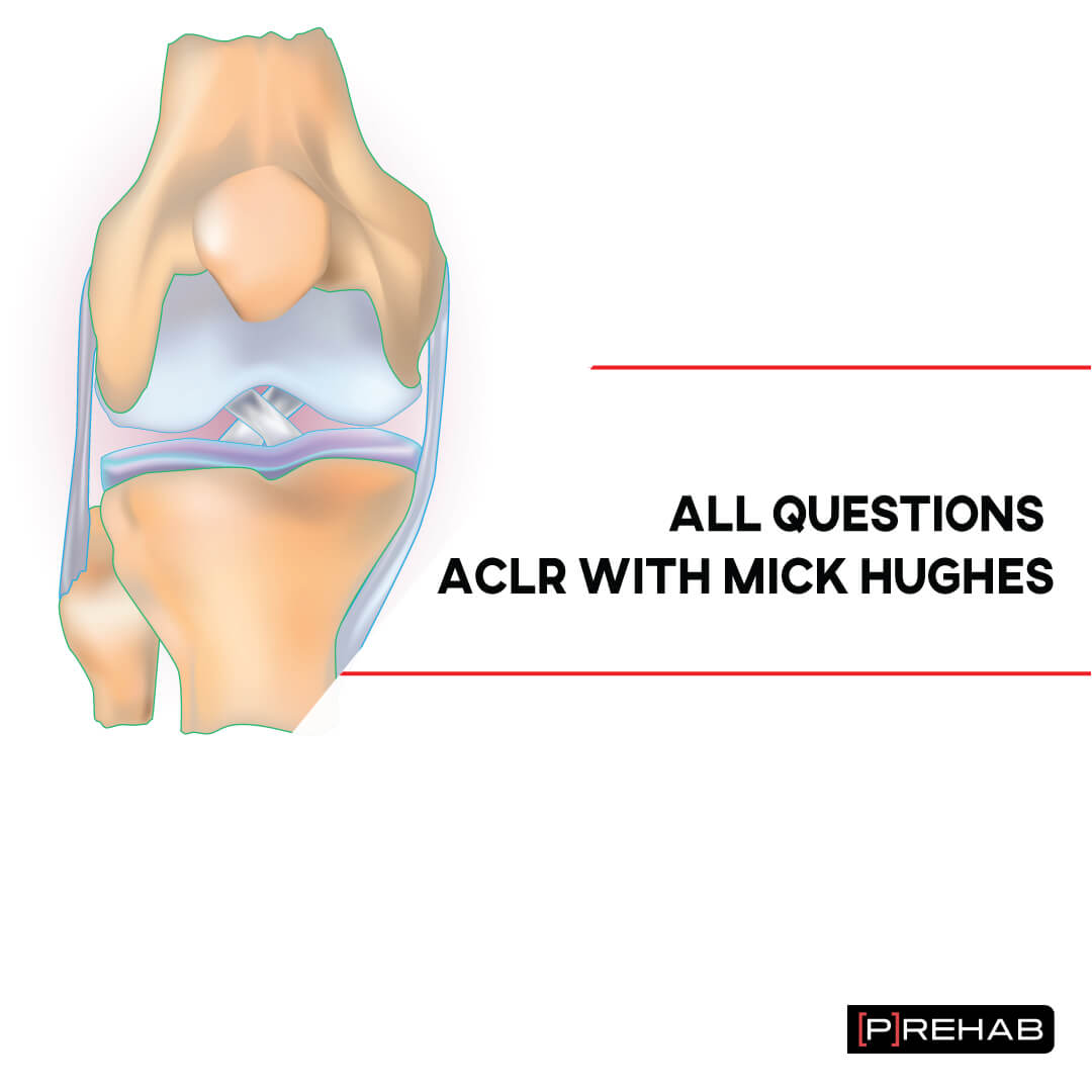 Common ACL Rehab Questions the prehab guys