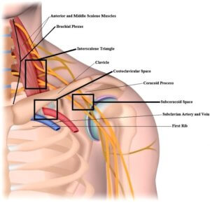 thoracic outlet relevant anatomy the prehab guys
