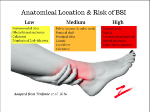 location and risk of bone stress injuries prehab guys