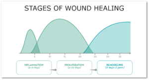 tissue healing timelines stages the prehab guys