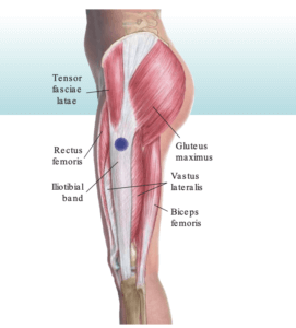 IT band anatomy runner's knee causes and treatment the prehab guys
