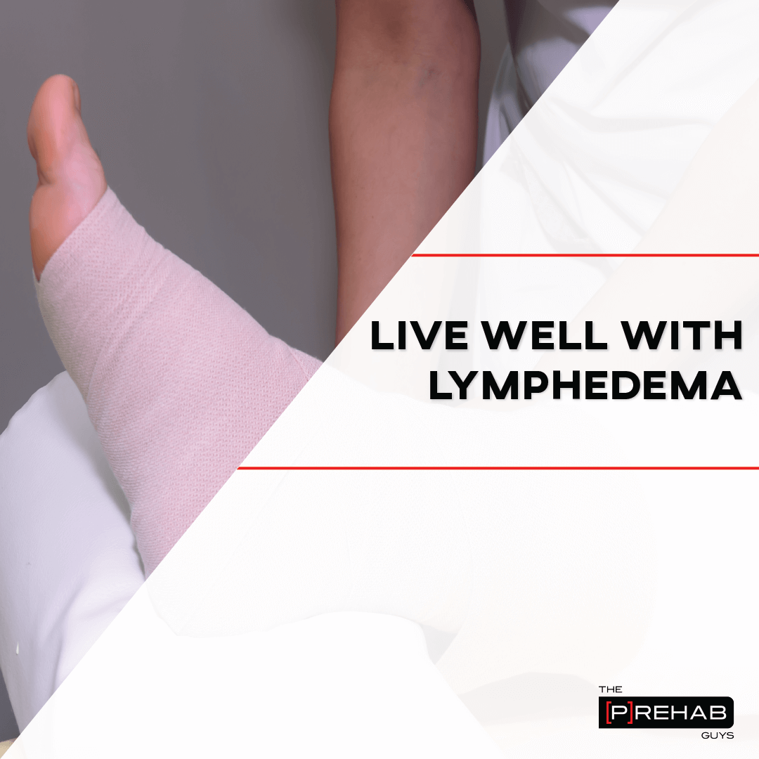 live well with lymphedema the prehab guys