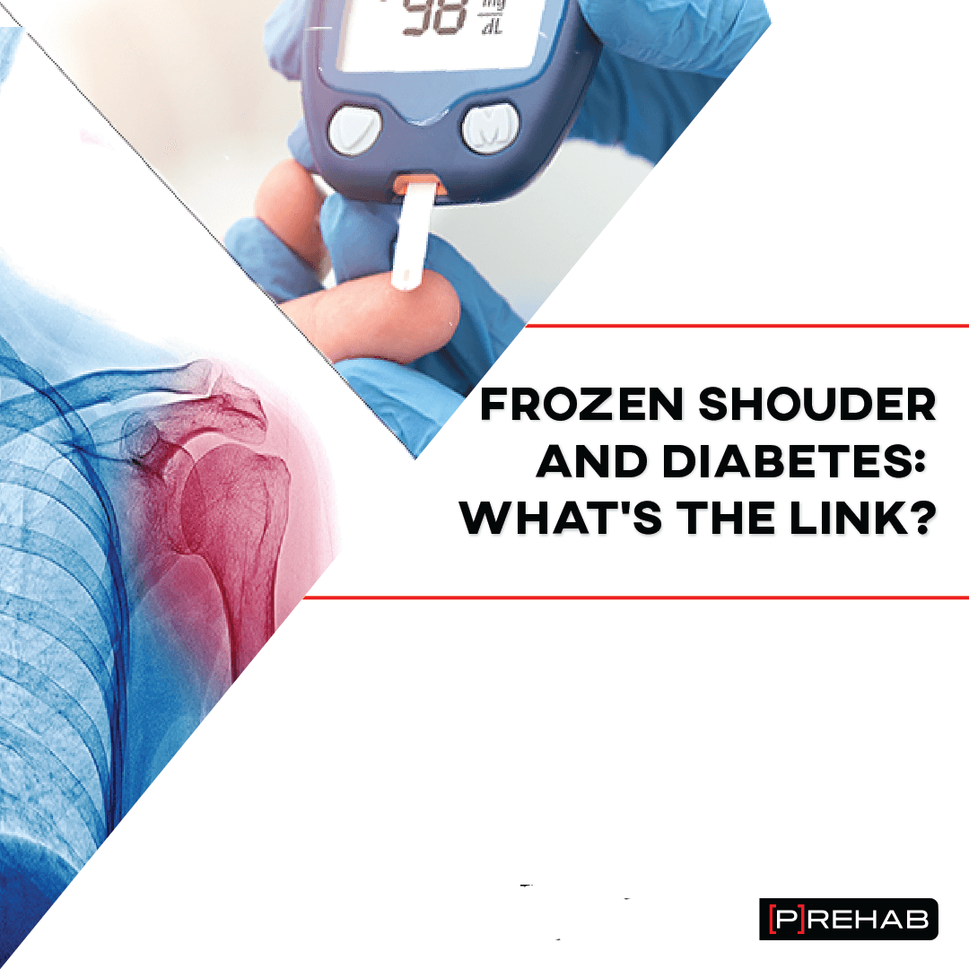 frozen shoulder and diabetes prehab guys