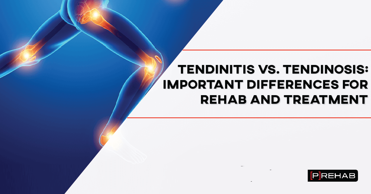 Difference Between Tendonitis And Tendinosis