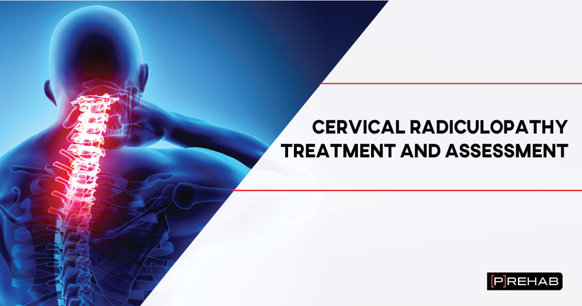 Cervical Radiculopathy Treatment And Assessment – [𝗣]𝗥𝗲𝗵𝗮𝗯