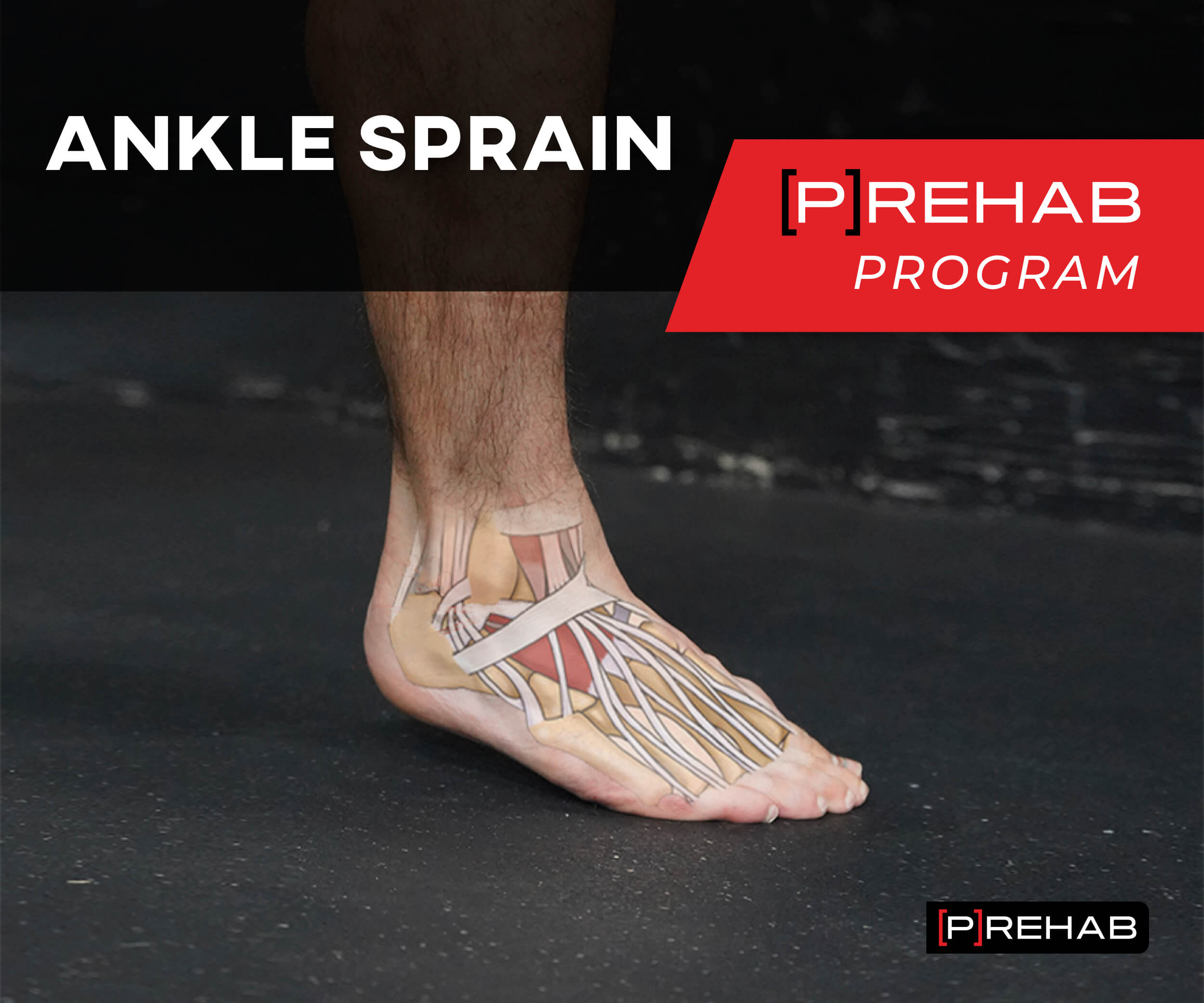 Ankle Sprain [P]Rehab Program | The Prehab Guys