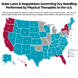 dry needling physical therapy state laws prehab guys