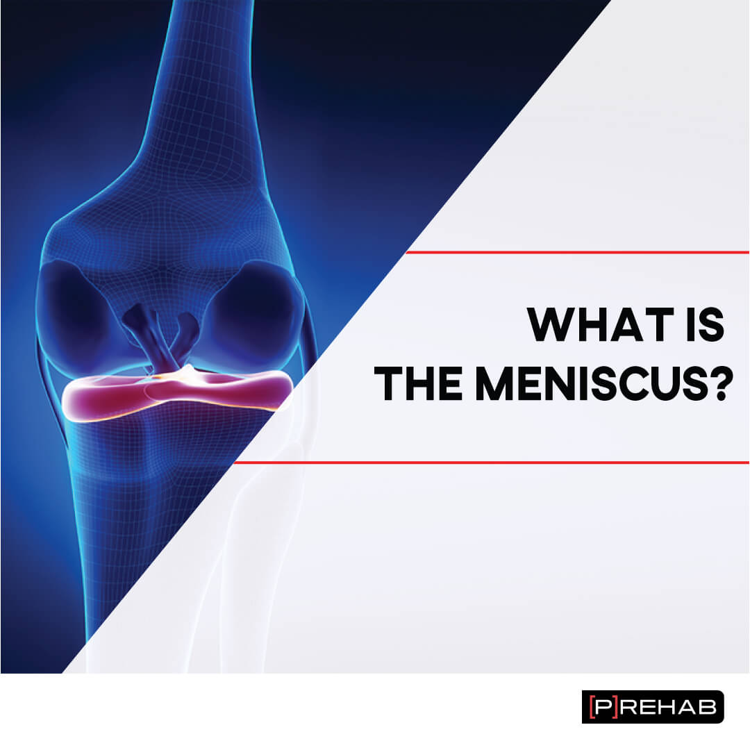 meniscus unhappy triad knee rehab the prehab guys