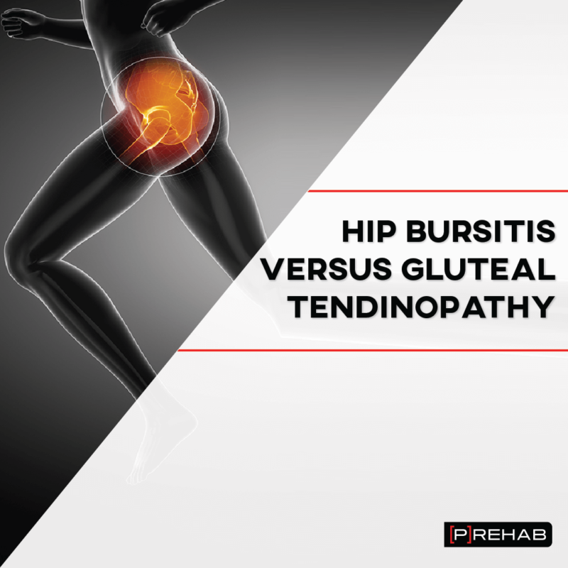 Hip Bursitis Versus Gluteal Tendinopathy – [𝗣]𝗥𝗲𝗵𝗮𝗯