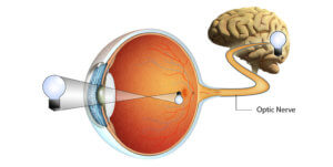 optic nerve the prehab guys