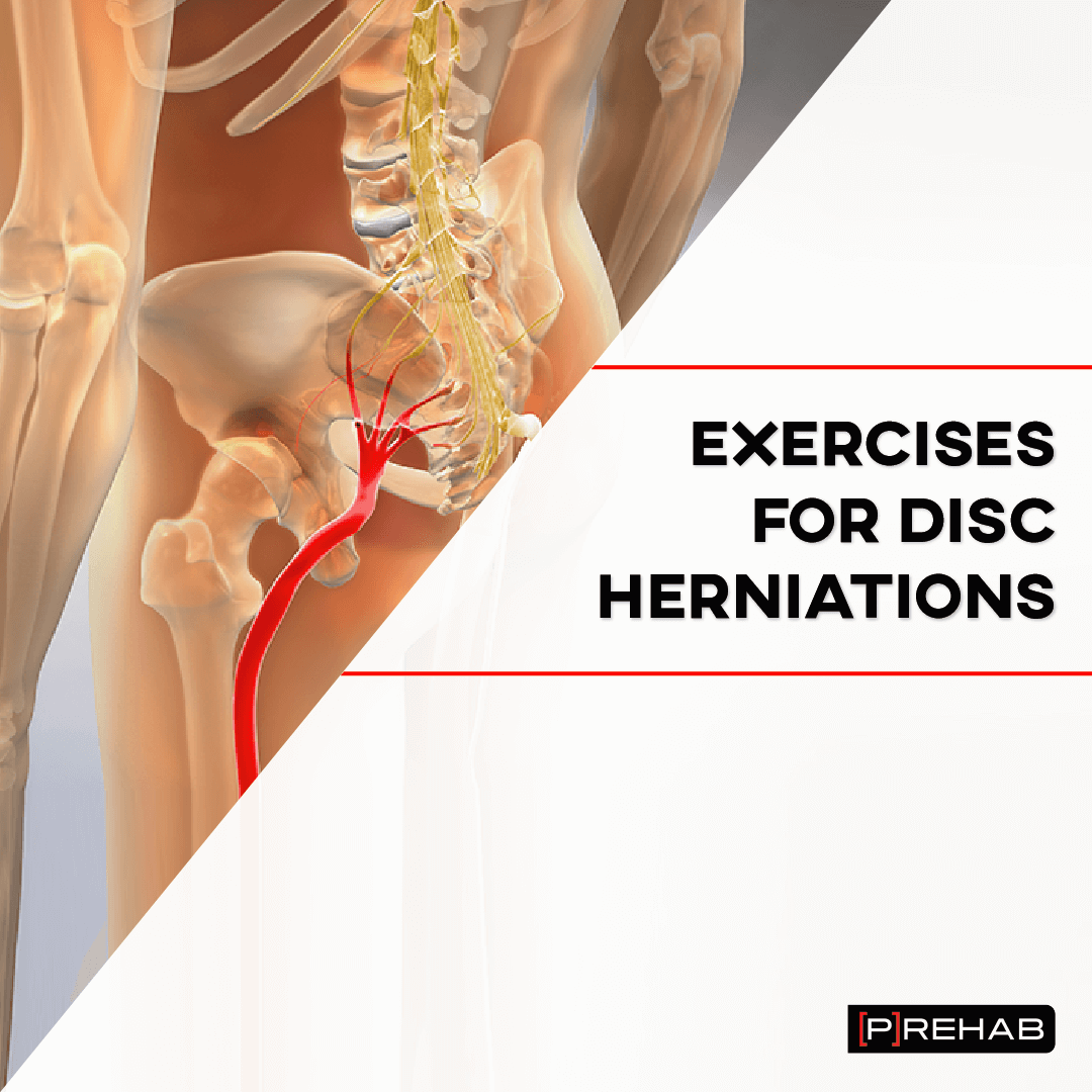 exercises for disc herniations the prehab guys