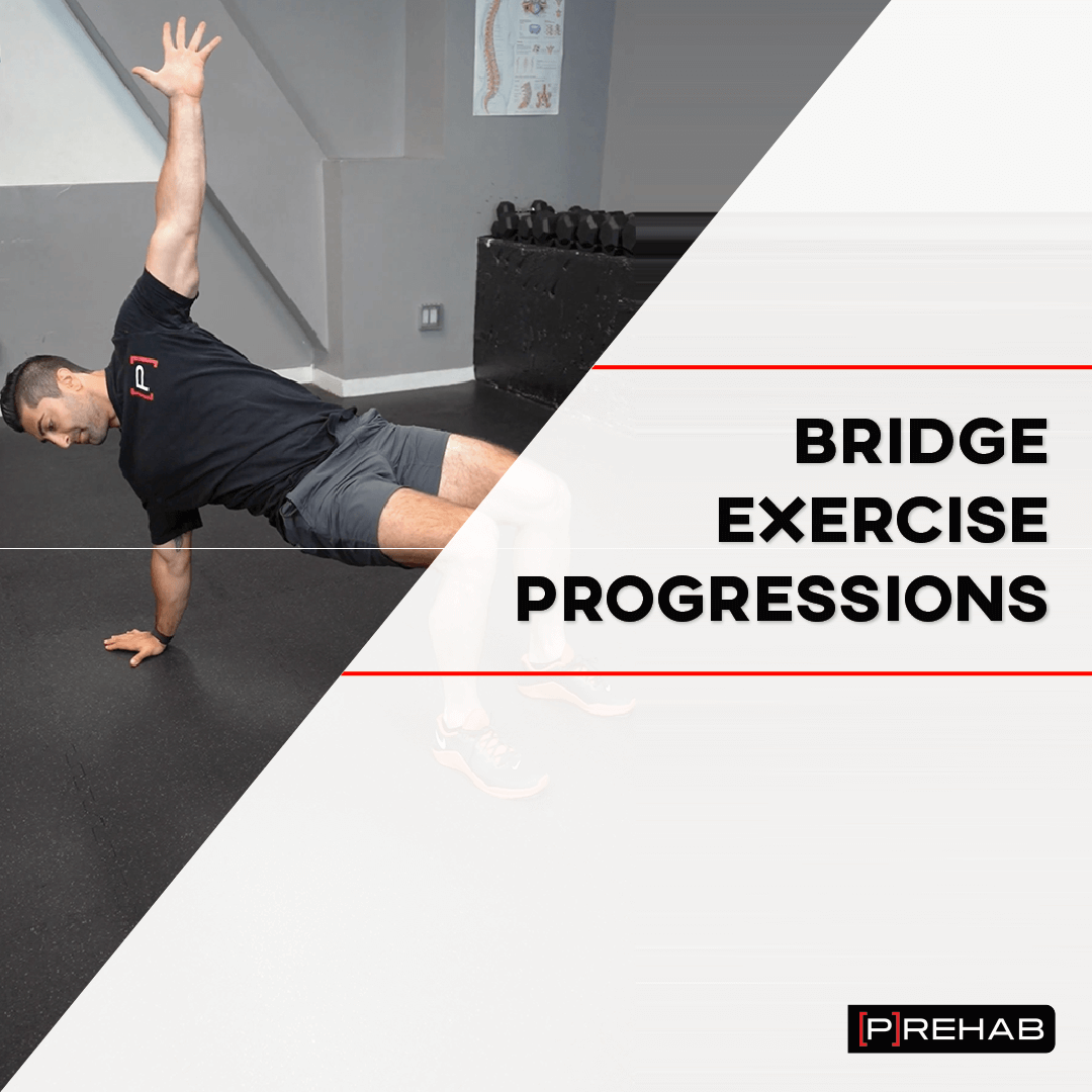 bridge exercise progressions clinical pearl the prehab guys