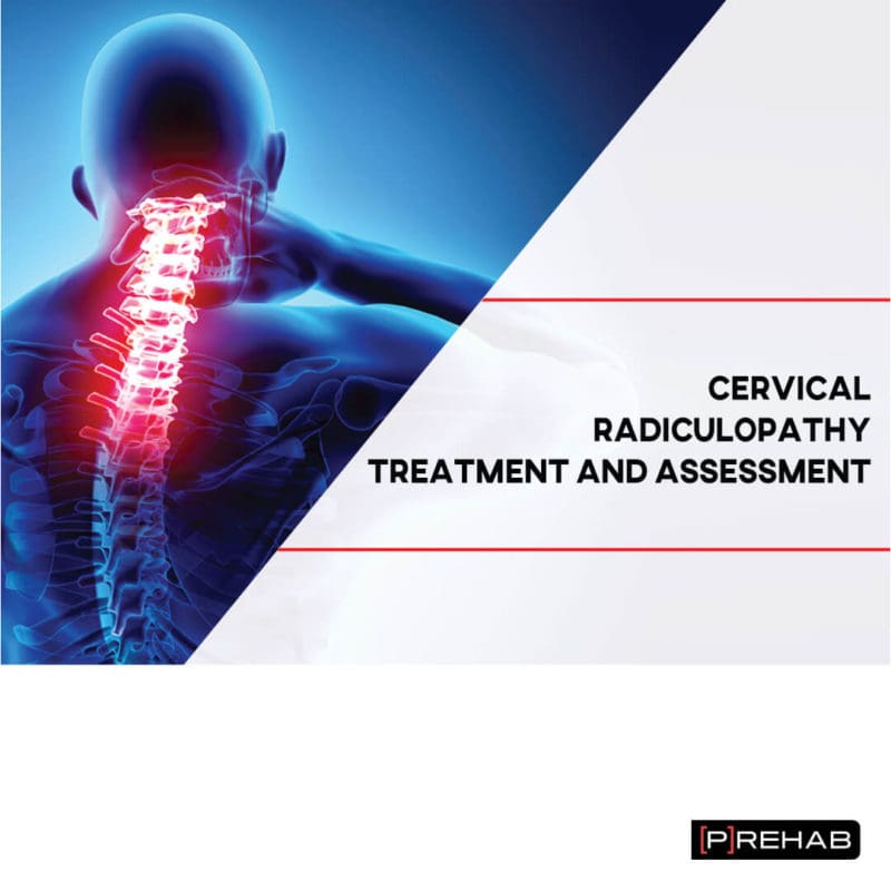 Cervical Radiculopathy Treatment And Assessment P Rehab