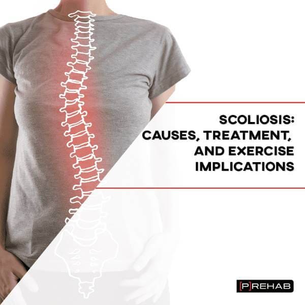 Scoliosis Treatment