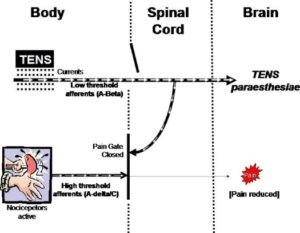 tens unit modalities and recovery gate control theory the prehab guys
