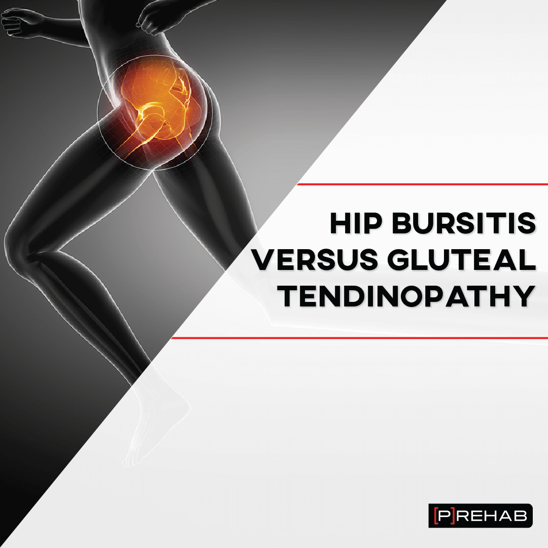 Hip Bursitis Versus Gluteal Tendinopathy - [P]rehab