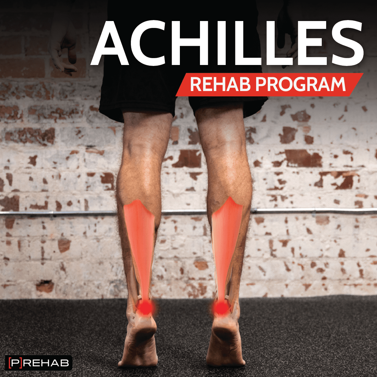 Achilles Rehab Program P rehab