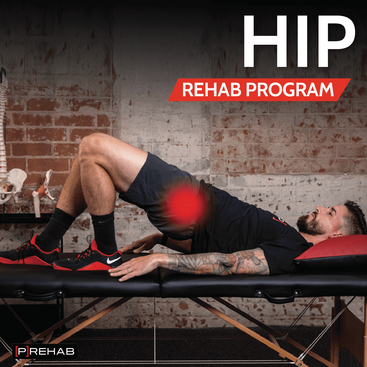 hip rehab program hip bursitis