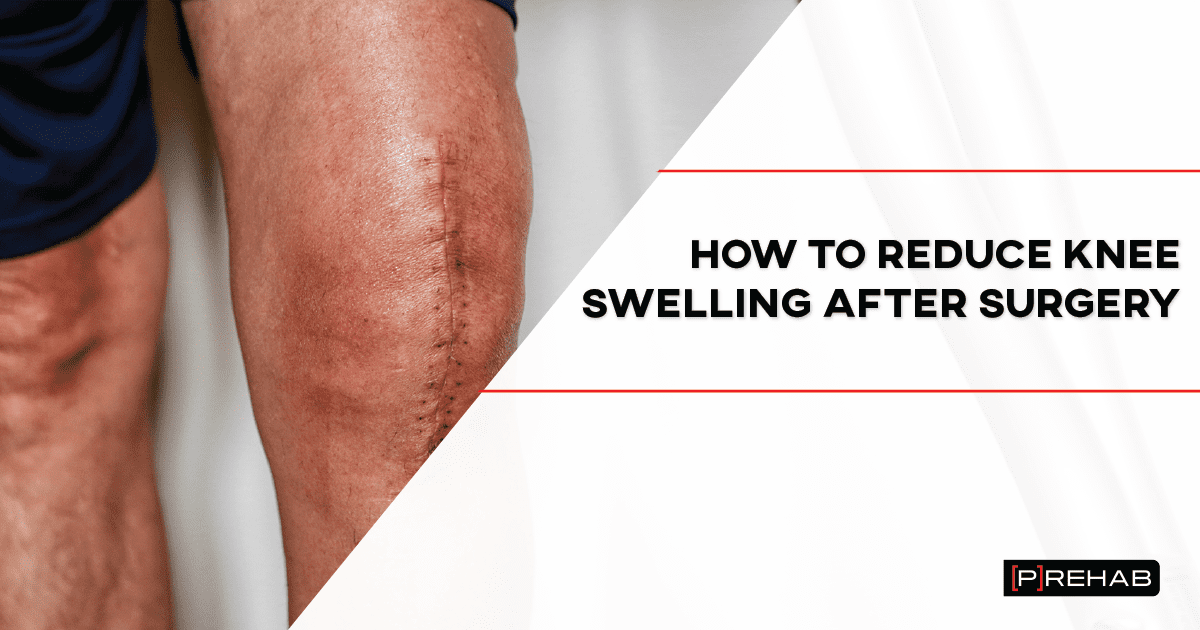 How To Reduce Knee Swelling After Surgery P Rehab 9310