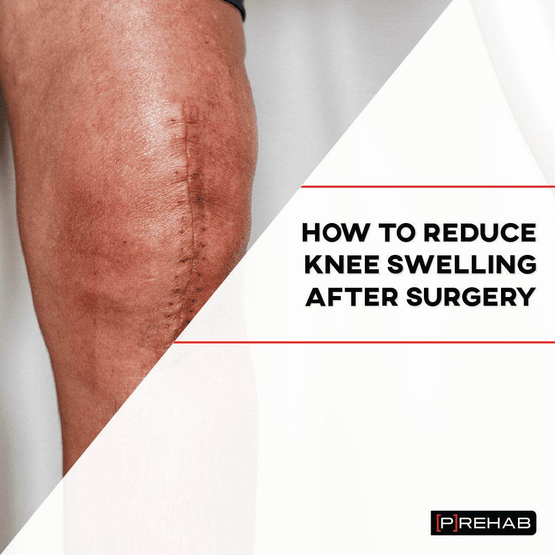 How To Reduce Knee Swelling After Surgery INSTAGRAM 