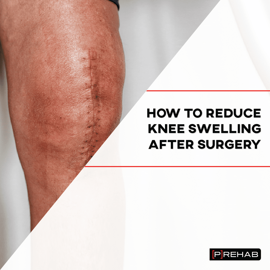 How Long Does It Take For Swelling To Go Down After A Fall