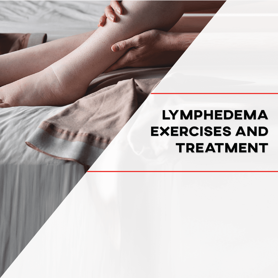 How to Do Arm Lymphedema Exercises