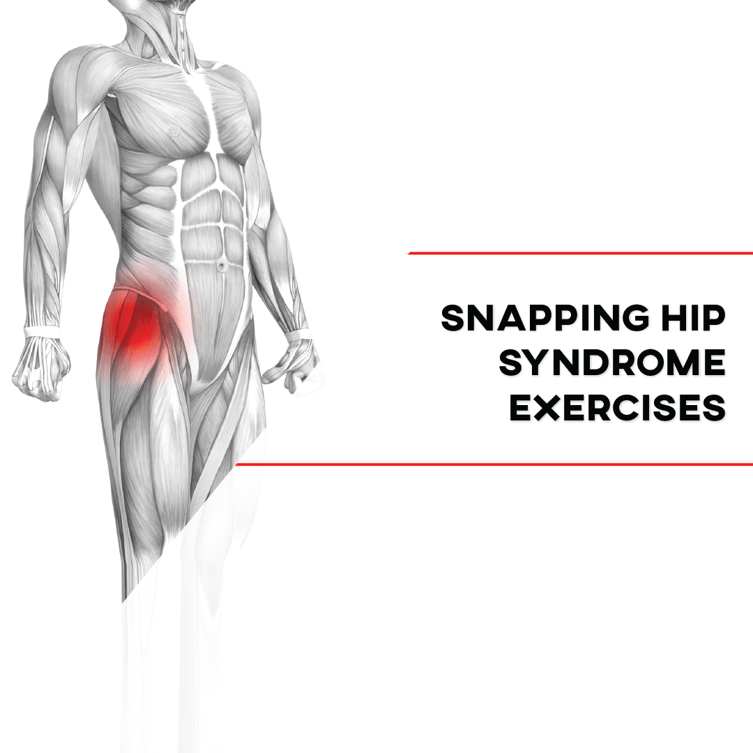 Exercises For Snapping Hip Syndrome P Rehab